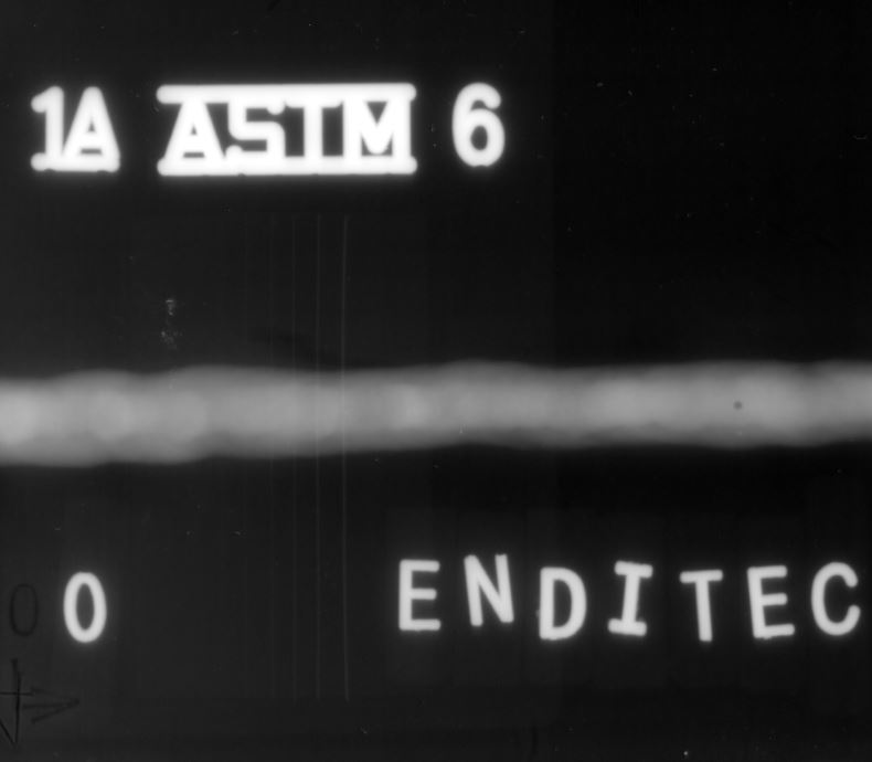 Ejemplo de radiografía